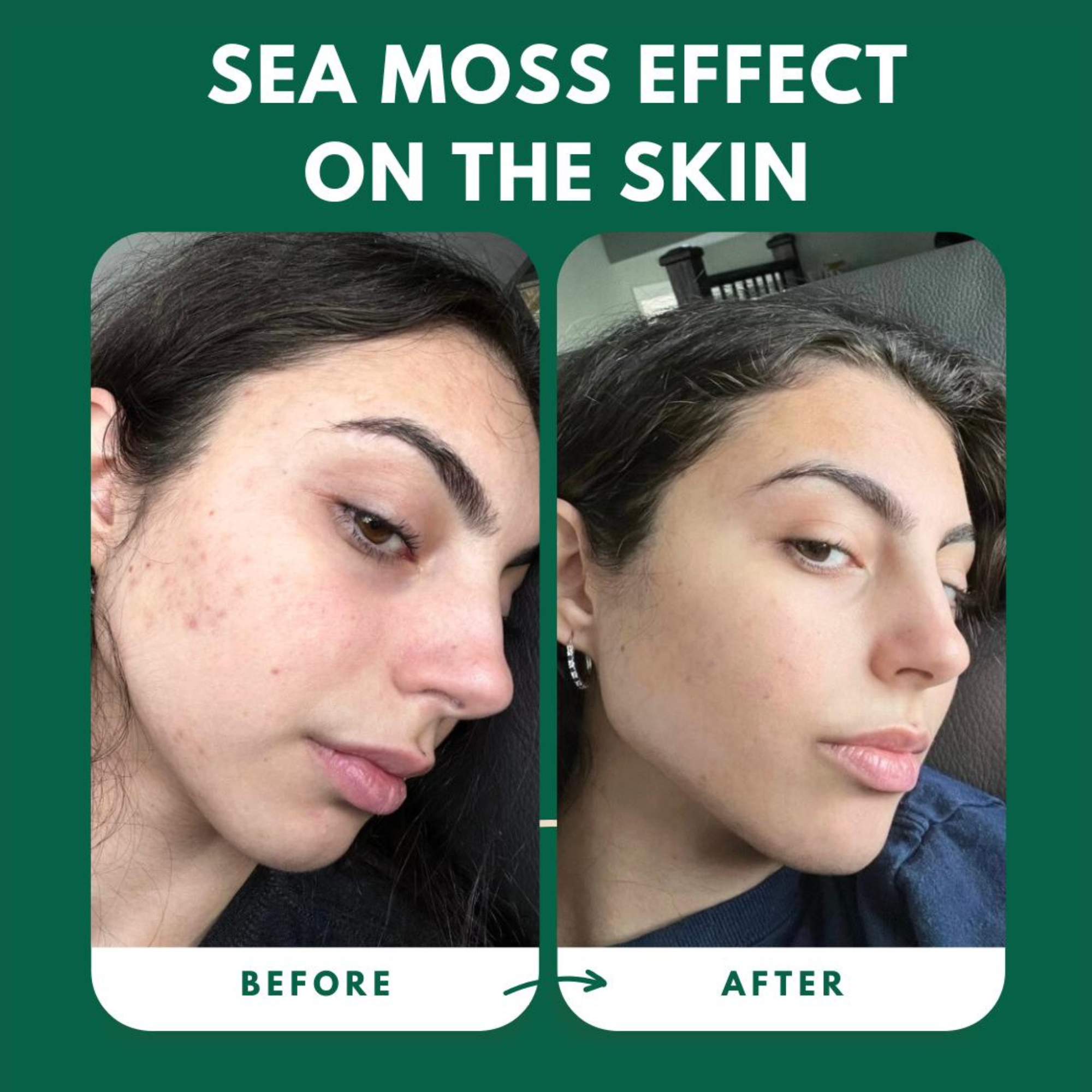 Sea Moss Gel
